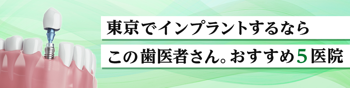 東京でインプラントするならこの歯医者さん。おすすめ5医院